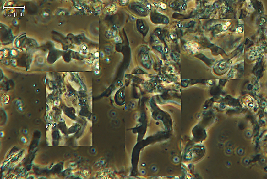 Amyloathelia amylacea (Bourdot & Galzin) Hjortstam & Ryvarde